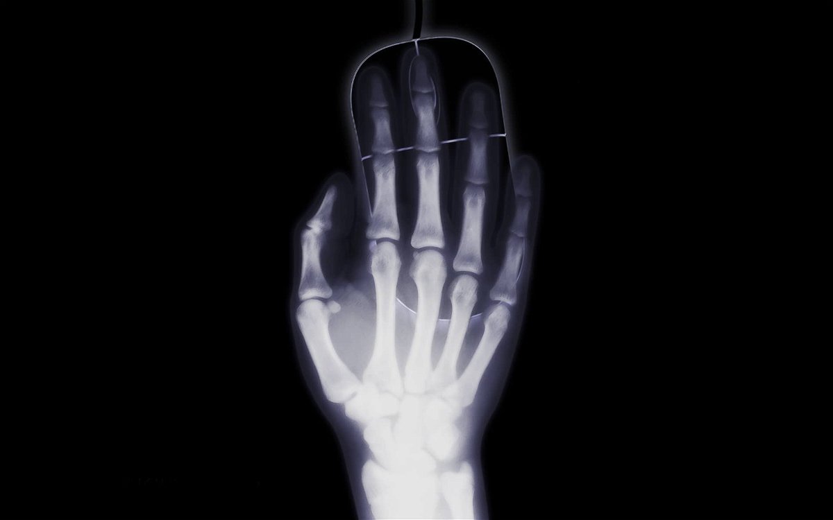 emberi röntgensugárzás