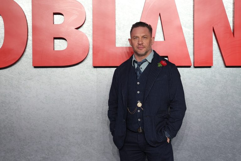 Rendkívül aggasztó Tom Hardy állapota, ami folyamatosan romlik