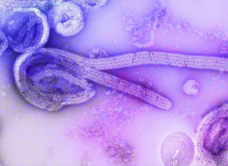 Ebolagyanús amerikai beteget kezelnek Prágában, huszonhatan karanténban
